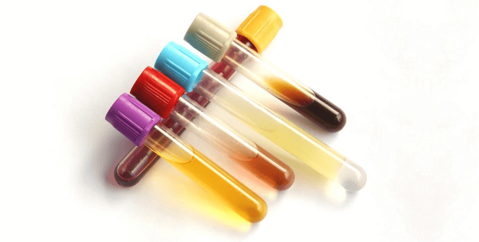 blood-tests-that-go-beyond-routine-cholesterol-checks-gaples-institute